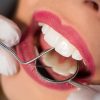 بهترین ایمپلنت شهرکرد | بهترین ایمپلنت اصفهان | بررسی انواع مواد برای ترمیم دندان