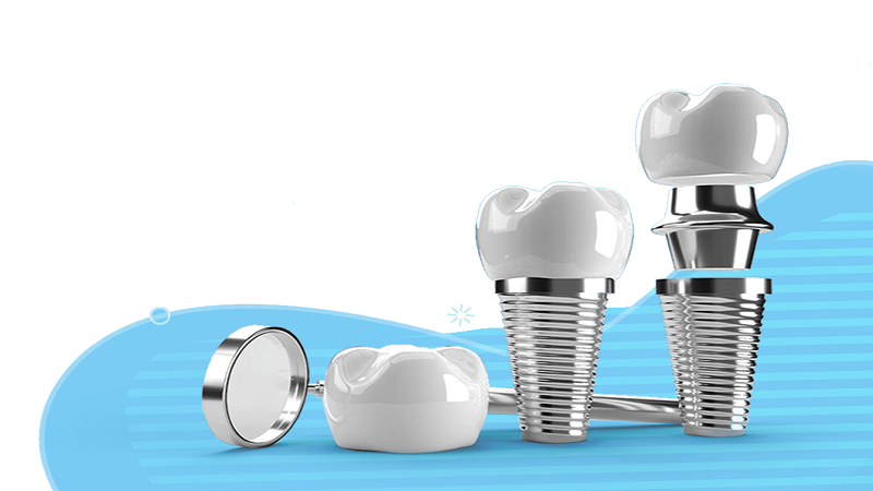 بهترین ایمپلنت اصفهان | بهترین ایمپلنت شهرکرد | دکتر مهران دانشمند | ضمانت قطعات و گارانتی عملکرد ایمپلنت دندان