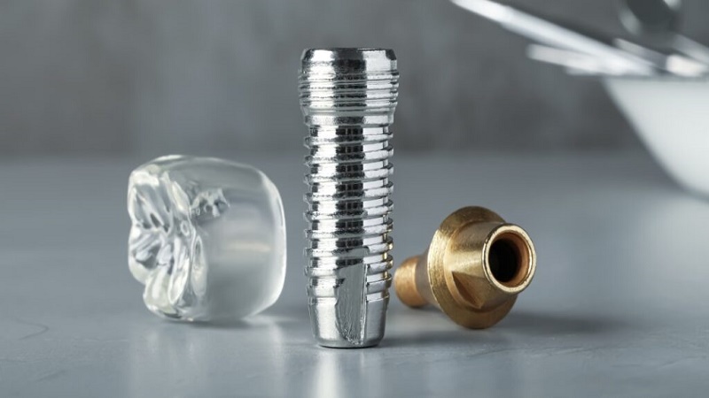 بهترین ایمپلنت اصفهان | بهترین ایمپلنت شهرکرد | دکتر مهران دانشمند | ۵ نشانه برای پوسیدن ایمپلنت دندان