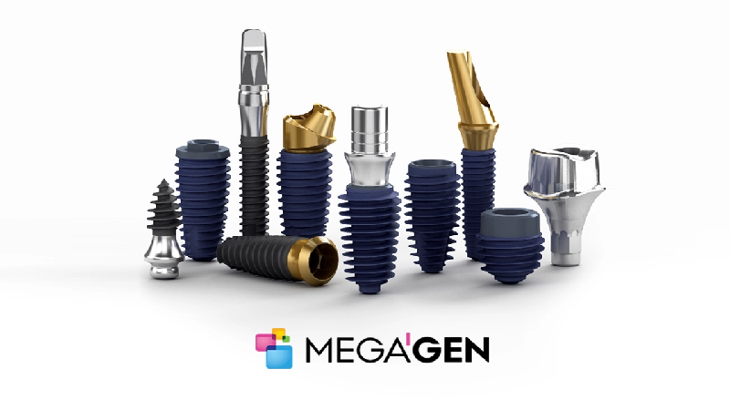 بهترین ایمپلنت اصفهان | بهترین ایمپلنت شهرکرد | دکتر مهران دانشمند | 9 مزیت ایمپلنت های کره ای مگاژن