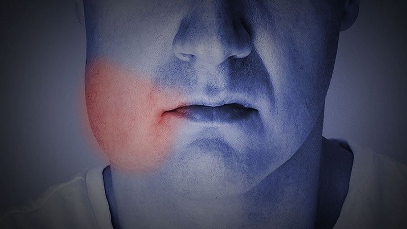 بهترین ایمپلنت اصفهان | بهترین ایمپلنت شهرکرد | دکتر مهران دانشمند | علل ورم صورت بعد از ایمپلنت