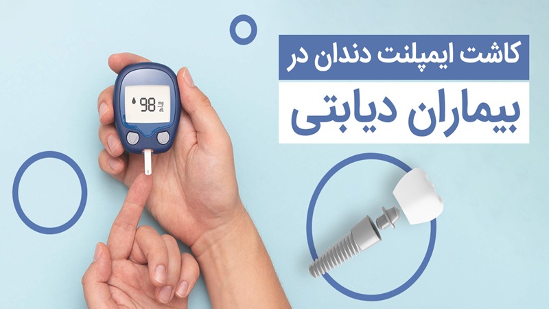 ایمپلنت دندان برای بیماران دیابتی | دکتر مهران دانشمند | بهترین ایمپلنت اصفهان | بهترین ایمپلنت شهرکرد