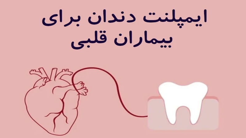 ایمپلنت دندان در بیماران قلبی | دکتر مهران دانشمند | بهترین ایمپلنت اصفهان | بهترین ایمپلنت شهرکرد